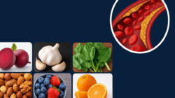 8 Makanan Ini Bisa Buka Sumbatan Pembuluh Darah Tanpa Obat, Nomor 4 Sering Kamu Abaikan!